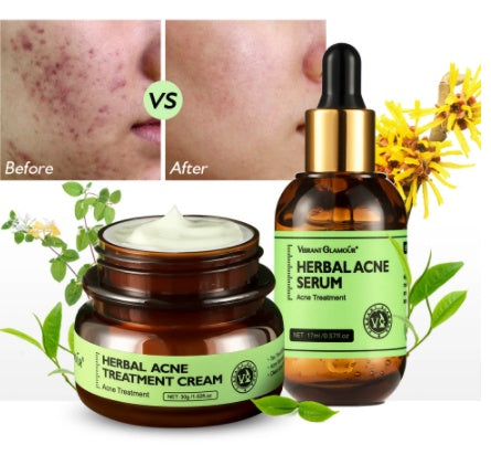 VIBRANT GLAMOUR Herbal Acne Cream 30g