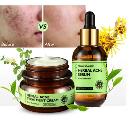 VIBRANT GLAMOUR Herbal Acne Cream 30g